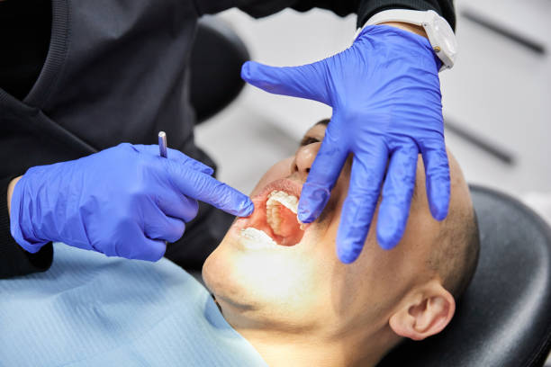 Best Emergency Treatment for Dental Infections or Abscesses in Palacios, TX