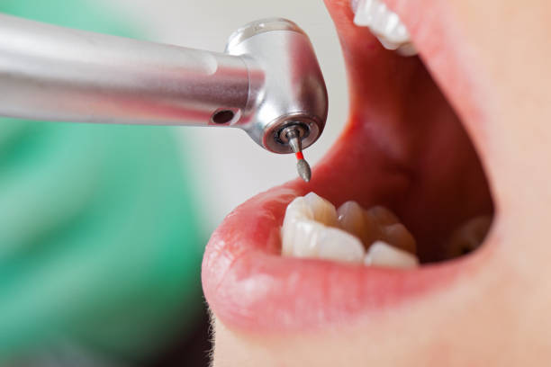 Best Emergency Denture Repair in Palacios, TX